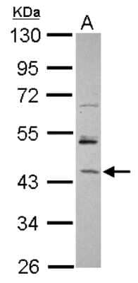 Western Blot: RBM17 Antibody [NBP2-20103] - Sample (30 ug of whole cell lysate) A: Raji 10% SDS PAGE gel, diluted at 1:500.