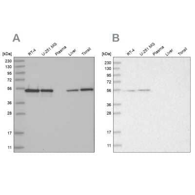 Western Blot RBM17 Antibody - BSA Free