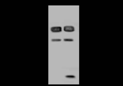 Western Blot: RBM17 Antibody [NBP2-97616] - Anti-RBM17 rabbit polyclonal antibody at 1:500 dilution. Lane A: U-251 MG Whole Cell Lysate Lane B: Raji Whole Cell Lysate Lysates/proteins at 30 ug per lane. Secondary Goat Anti-Rabbit IgG (H+L)/HRP at 1/10000 dilution. Developed using the ECL technique. Performed under reducing conditions. Predicted band size: 45 kDa. Observed band size: 45 kDa