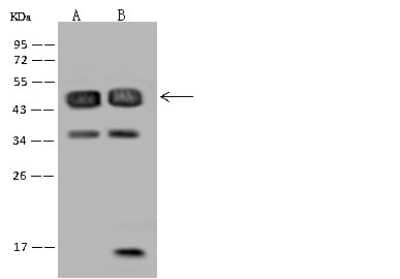 Western Blot: RBM17 Antibody [NBP2-97616] - Anti-RBM17 rabbit polyclonal antibody at 1:500 dilution. Lane A: U-251 MG Whole Cell Lysate Lane B: Raji Whole Cell Lysate Lysates/proteins at 30 ug per lane. Secondary Goat Anti-Rabbit IgG (H+L)/HRP at 1/10000 dilution. Developed using the ECL technique. Performed under reducing conditions. Predicted band size: 45 kDa. Observed band size: 45 kDa