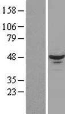 Western Blot: RBM17 Overexpression Lysate (Adult Normal) [NBL1-15198] Left-Empty vector transfected control cell lysate (HEK293 cell lysate); Right -Over-expression Lysate for RBM17.