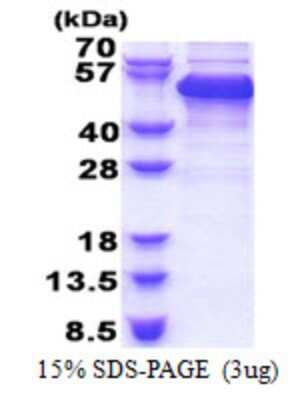 SDS-PAGE Recombinant Human RBM17 His Protein