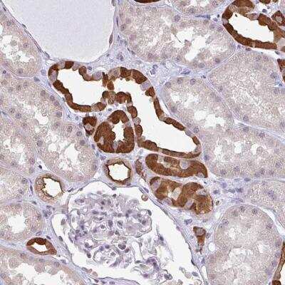Immunohistochemistry-Paraffin: RBM18 Antibody [NBP2-31670] - Staining of human kidney shows strong cytoplasmic and nuclear positivity in subset of tubules.