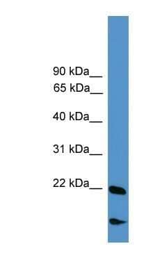 Western Blot: RBM18 Antibody [NBP1-80471] - Titration: 0.2-1 ug/ml, Positive Control: COLO205 cell lysate.