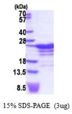 SDS-PAGE Recombinant Human RBM18 His Protein
