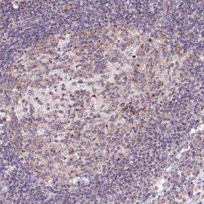 Immunohistochemistry: RBM19 Antibody [NBP1-84135] - Immunohistochemical staining of human lymph node shows moderate nuclear positivity in germinal center cells.