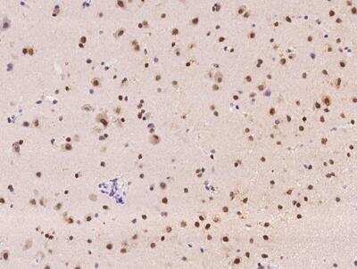 Immunohistochemistry-Paraffin: RBM19 Antibody [NBP3-12591] - Staining of human RBM19 in human brain with rabbit polyclonal antibody at 1:100 dilution.