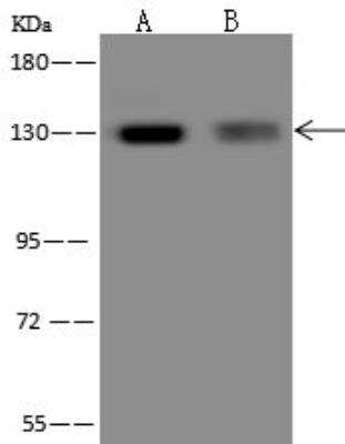 Western Blot: RBM19 Antibody [NBP3-12591] - Lane A: U-251 MG Whole Cell LysateLane B: 293T Whole Cell LysateLysates/proteins at 30 ug per lane.SecondaryGoat Anti-Rabbit IgG (H+L)/HRP at 1/10000 dilution.Developed using the ECL technique.Performed under reducing conditions.Predicted band size:107 kDaObserved band size:130 kDa