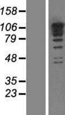 Western Blot: RBM19 Overexpression Lysate (Adult Normal) [NBP2-10220] Left-Empty vector transfected control cell lysate (HEK293 cell lysate); Right -Over-expression Lysate for RBM19.
