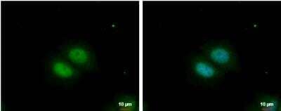 Immunocytochemistry/Immunofluorescence: RBM22 Antibody [NBP2-20104] - MCF-7 cells were fixed in 4% paraformaldehyde at RT for 15 min. Green: RBM22 protein stained by RBM22 antibody  diluted at 1:500. Blue: Hoechst 33342 staining. Scale bar = 10 um