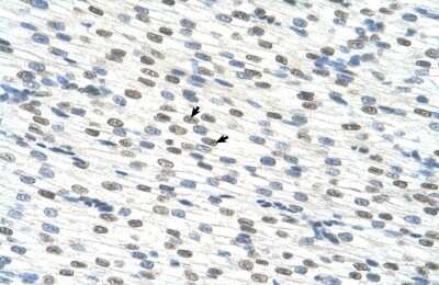 Immunohistochemistry-Paraffin: RBM22 Antibody [NBP1-57327] - Human Heart Tissue, antibody concentration 4-8ug/ml. Cells with positive label: Myocardial cells (indicated with arrows) 400X magnification.