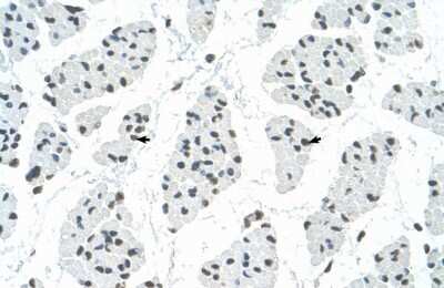 Immunohistochemistry-Paraffin: RBM22 Antibody [NBP1-57327] - Human Muscle Tissue, Skeletal muscle cells (Indicated with Arrows) 4-8ug/ml.