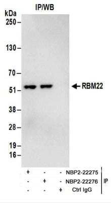 <b>Biological Strategies Validation. </b>Immunoprecipitation: RBM22 Antibody [NBP2-22275] - Whole cell lysate (1 mg for IP; 20% of IP loaded) from 293T cells.  Antibodies: Affinity purified rabbit anti-RBM22 antibody NBP2-22275 used for IP at 6 ug/mg lysate.  RBM22 was also immunoprecipitated by rabbit anti-RBM22 antibody NBP2-22276.  For blotting immunoprecipitated RBM22, NBP2-22275 was used at 1 ug/ml.  Detection: Chemiluminescence with an exposure time of 3 seconds.