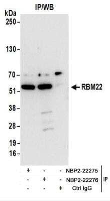 <b>Biological Strategies Validation. </b>Immunoprecipitation: RBM22 Antibody [NBP2-22276] - Whole cell lysate (1 mg for IP; 20% of IP loaded) from 293T cells.  Antibodies:  Affinity purified rabbit anti-RBM22 antibody NBP2-22276 used for IP at 6 ug/mg lysate.  RBM22 was also immunoprecipitated by rabbit anti-RBM22 antibody NBP2-22275.  For blotting immunoprecipitated RBM22, NBP2-22276 was used at 1 ug/ml.  Detection: Chemiluminescence with an exposure time of 3 seconds.