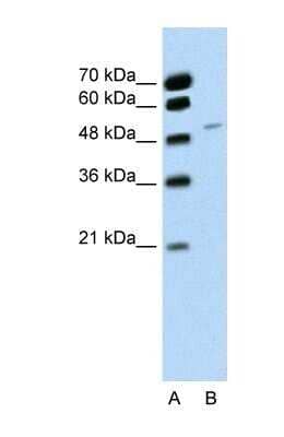 Western Blot: RBM22 Antibody [NBP1-57327] - Jurkat cell lysate, Antibody Titration: 0.2-1 ug/ml