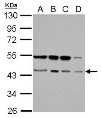 Western Blot: RBM22 Antibody [NBP2-20104] - Sample (30 ug of whole cell lysate) A: Jurkat B: Raji C: K562 D: THP-1 10% SDS PAGE gel, diluted at 1:1000.
