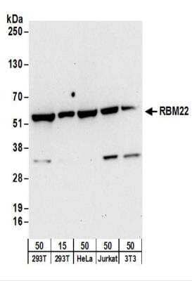 Western Blot: RBM22 Antibody [NBP2-22276] - Whole cell lysate from 293T (15 and 50 ug), HeLa (50 ug), Jurkat (50 ug), and mouse NIH3T3 (50 ug) cells.  NBP2-22276 used for WB at 0.1 ug/ml.  Detection: Chemiluminescence with an exposure time of 30 seconds.