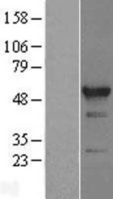 Western Blot: RBM22 Overexpression Lysate (Adult Normal) [NBL1-15200] Left-Empty vector transfected control cell lysate (HEK293 cell lysate); Right -Over-expression Lysate for RBM22.