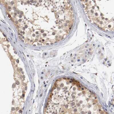 Immunohistochemistry-Paraffin RBM23 Antibody - BSA Free