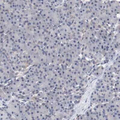 Immunohistochemistry-Paraffin RBM23 Antibody - BSA Free