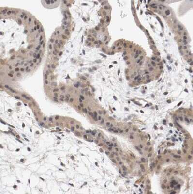 Immunohistochemistry-Paraffin RBM23 Antibody - BSA Free