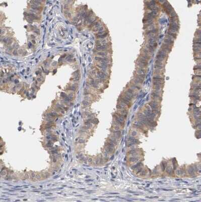 Immunohistochemistry-Paraffin RBM23 Antibody - BSA Free
