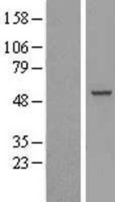Western Blot RBM23 Overexpression Lysate