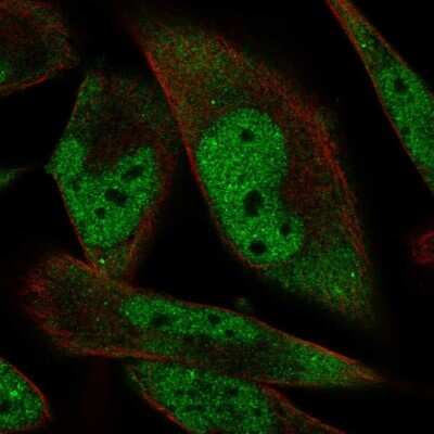 Immunocytochemistry/ Immunofluorescence RBM24 Antibody - BSA Free