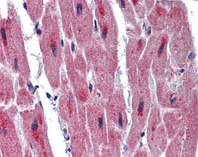 Immunohistochemistry-Paraffin RBM24 Antibody - BSA Free