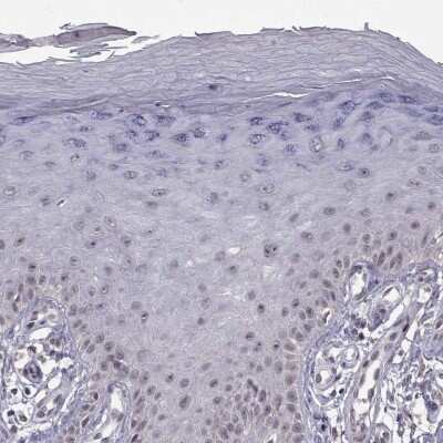Immunohistochemistry-Paraffin RBM24 Antibody - BSA Free