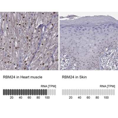 Immunohistochemistry-Paraffin: RBM24 Antibody [NBP2-57328] - Staining in human heart muscle and skin tissues using anti-RBM24 antibody. Corresponding RBM24 RNA-seq data are presented for the same tissues.