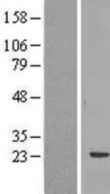 Western Blot RBM24 Overexpression Lysate
