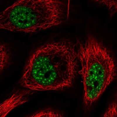 Immunocytochemistry/Immunofluorescence: RBM25 Antibody [NBP2-57656] - Staining of human cell line HaCaT shows localization to nuclear speckles.