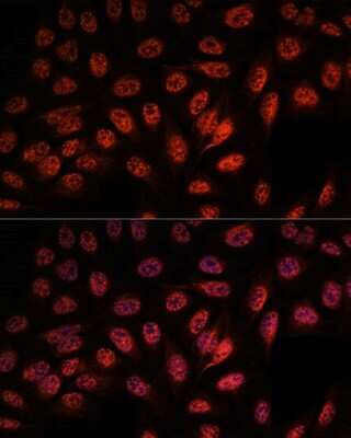 Immunocytochemistry/Immunofluorescence: RBM25 Antibody [NBP2-93951] - Analysis of U-2 OS cells using RBM25 at dilution of 1:100. Blue: DAPI for nuclear staining.