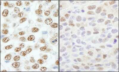 <b>Independent Antibodies Validation. </b>Immunohistochemistry-Paraffin: RBM25 Antibody [NB100-57506] - Sample: FFPE sections of human testicular seminoma (left) and mouse CT26 colon carcinoma (right). Antibody: Affinity purified rabbit anti- RBM25/RED120 used at a dilution of 1:200 (1 ug/ml). Detection: DAB