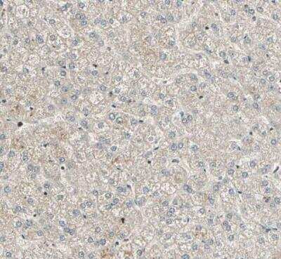 Immunohistochemistry-Paraffin: RBM25 Antibody [NBP1-83418] - Staining of human liver shows no positivity in hepatocytes as expected.