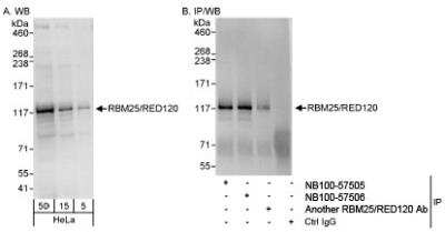 Western Blot: RBM25 Antibody [NB100-57505] - Detection of Human RBM25/RED120 on HeLa whole cell lysate using NB100-57505. RBM25/RED120 was also IPed by rabbit anti-RBM25/RED120 antibodies NB100-57506 and another RBM25/RED120.