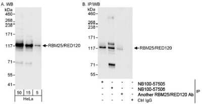 Western Blot: RBM25 Antibody [NB100-57506] - Detection of Human RBM25/RED120 on HeLa whole cell lysate usingy NB100-57506. RBM25 was also immunoprecipitated by anaother rabbit anti-RBM25 antibody and NB100-57505.