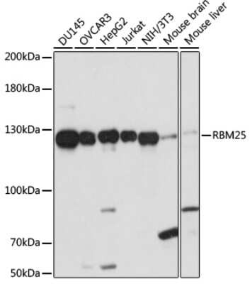 Western Blot: RBM25 Antibody [NBP2-93951] - Analysis of extracts of various cell lines, using RBM25 at 1:1000 dilution. Secondary antibody: HRP Goat Anti-Rabbit IgG (H+L) at 1:10000 dilution. Lysates/proteins: 25ug per lane. Blocking buffer: 3% nonfat dry milk in TBST. Detection: ECL Basic Kit . Exposure time: 60s.