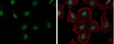 Immunocytochemistry/Immunofluorescence: RBM26 Antibody [NBP2-20105] - HeLa cells were fixed in 4% paraformaldehyde at RT for 15 min. Green: RBM26 protein stained by RBM26 antibody [C1C2], Internal diluted at 1:500. Red: phalloidin, a cytoskeleton marker, diluted at 1:200. Blue: Hoechst 33342 staining. Scale bar = 10 um.