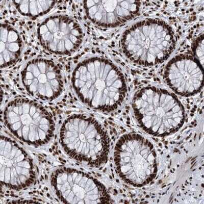 Immunohistochemistry-Paraffin: RBM26 Antibody [NBP1-89007] - Staining of human rectum shows strong nuclear positivity in glandular cells.
