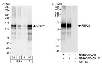 Western Blot: RBM26 Antibody [NB100-60408] - Detection of Human RBM26 on HeLa whole cell lysate using NB100-60408. RBM26 was also immunoprecipitated by rabbit anti-RBM26 antibody NB100-60409.