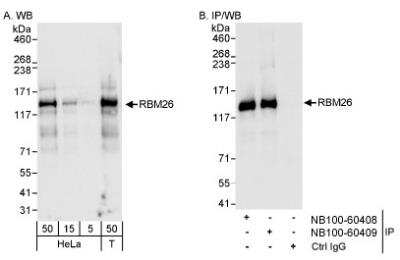 Western Blot: RBM26 Antibody [NB100-60409] - Detection of Human RBM26 on HeLa whole cell lysate using NB100-60409. RBM26 was also immunoprecipitated by rabbit anti-RBM26 antibody NB100-60408.