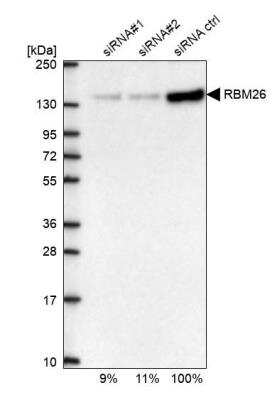Western Blot: RBM26 Antibody [NBP1-89007] - Analysis in U2OS cells transfected with control siRNA, target specific siRNA probe #1 and #2. Remaining relative intensity is presented.