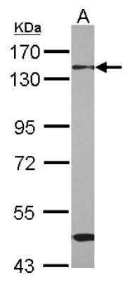 Western Blot: RBM26 Antibody [NBP2-20105] - Sample (30 ug of whole cell lysate) A: HepG2 7. 5% SDS PAGE gel, diluted at 1:1000.