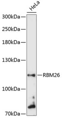 Western Blot: RBM26 Antibody [NBP2-94368] - Analysis of extracts of HeLa cells, using RBM26 at 1:3000 dilution.Secondary antibody: HRP Goat Anti-Rabbit IgG (H+L) at 1:10000 dilution.Lysates/proteins: 25ug per lane.Blocking buffer: 3% nonfat dry milk in TBST.Detection: ECL Basic Kit .Exposure time:
