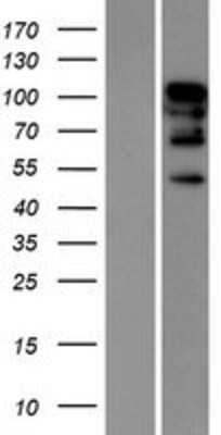 Western Blot: RBM26 Overexpression Lysate (Adult Normal) [NBP2-06472] Left-Empty vector transfected control cell lysate (HEK293 cell lysate); Right -Over-expression Lysate for RBM26.
