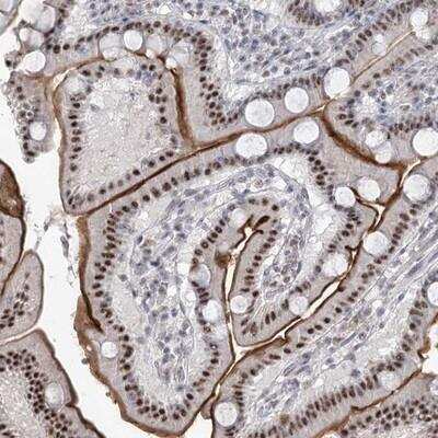 Immunohistochemistry-Paraffin: RBM27 Antibody [NBP1-90817] - Staining of human duodenum shows strong nuclear and membranous positivity in glandular cells.