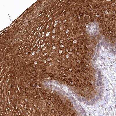 Immunohistochemistry-Paraffin: RBM27 Antibody [NBP1-90818] - Staining of human esophagus shows strong cytoplasmic positivity in squamous epithelial cells.