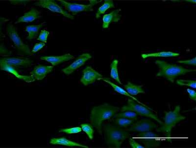 Immunocytochemistry/Immunofluorescence: RBM3 Antibody (4D6) [H00005935-M06] - Analysis of monoclonal antibody to RBM3 on HeLa cell. Antibody concentration 40 ug/ml